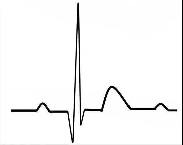 基础心电图速成大法