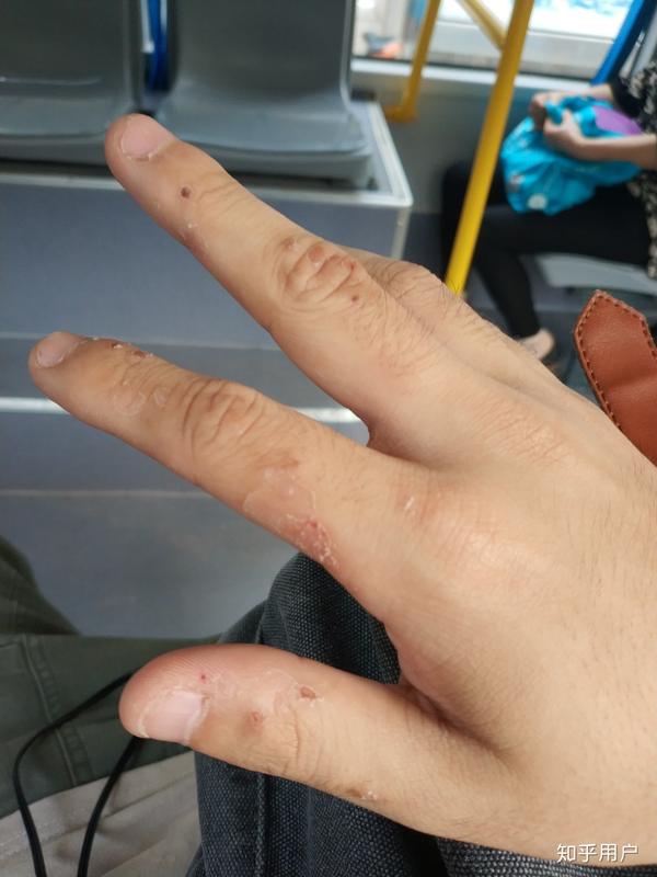 拥有一双不好看的手是种怎样的体验?