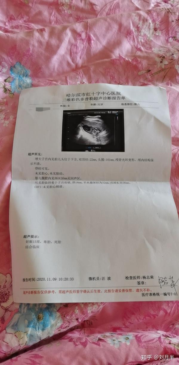 13周胎儿膀胱大单脐动脉15周胎停引产