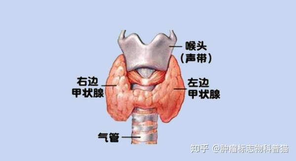 甲状腺癌的分类以及高危人群