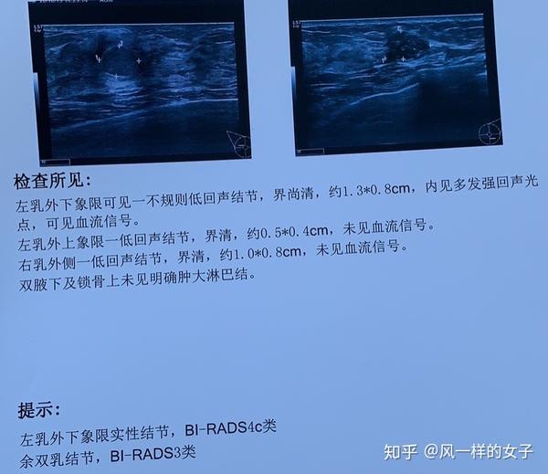 乳腺癌,how do i face it?