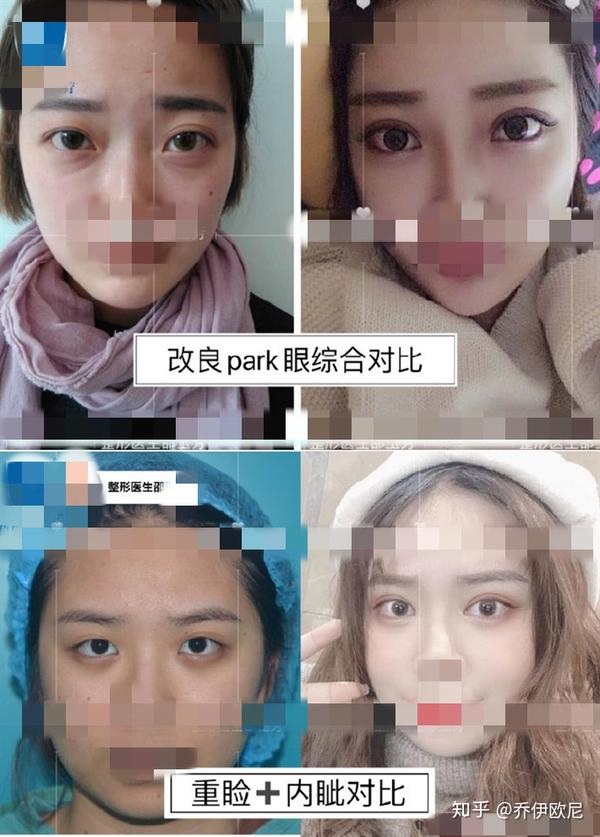 全国一线城市双眼皮医生综合测评