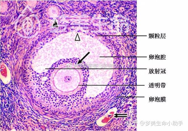 follicle) 卵泡腔(follicular antrum):系由初级卵母细胞周围的卵泡