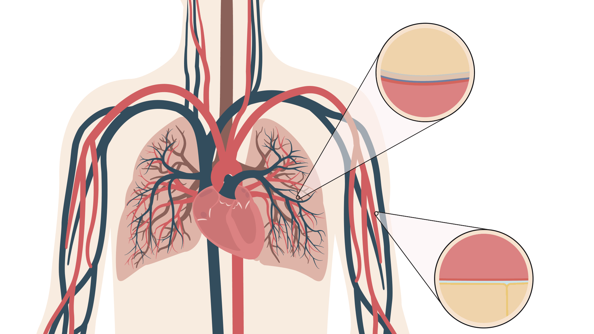 虽然当时对于疾病的来龙去脉都不太明白,但瘫痪和呼吸衰竭是显而易见