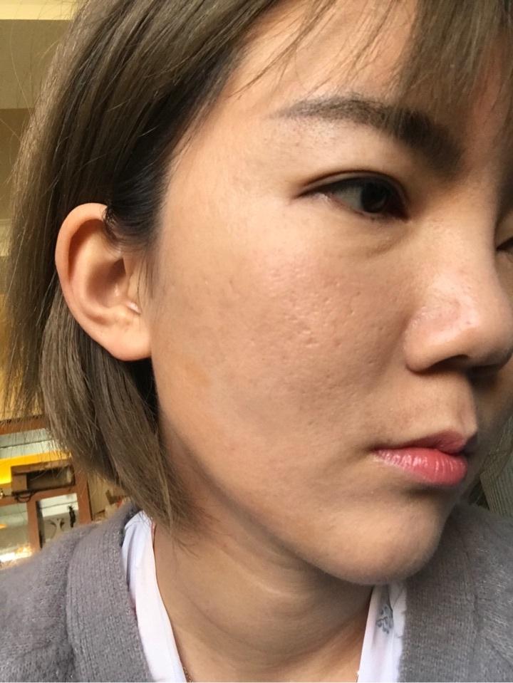 冬季护肤加班熬夜秒变黄脸婆那你该加水啦