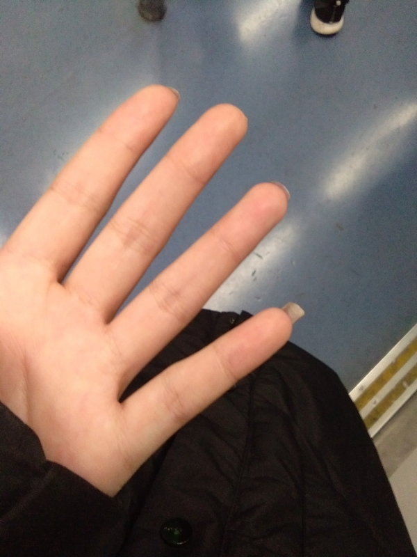 女孩子手长得丑,关节大且扭曲之类的,像枯枝一样是什么体验?