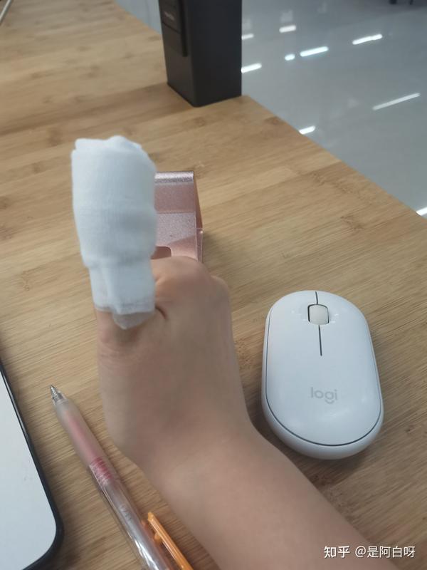 右手大拇指被切下一块后恢复记录(皮和肉未贴回,持续更新)
