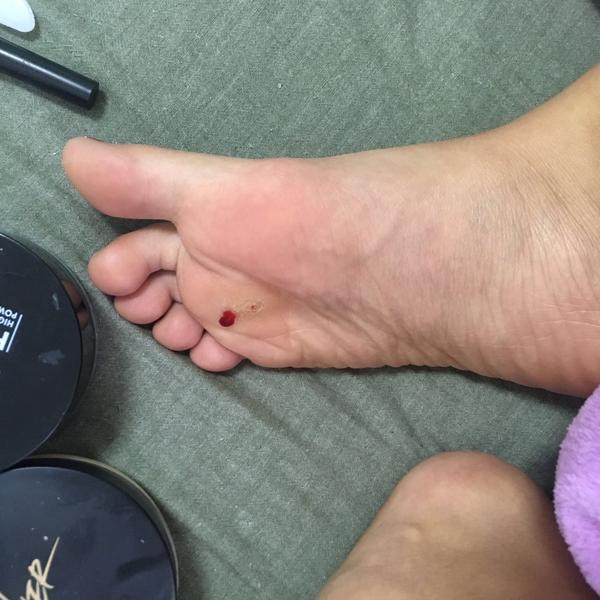 其实就是布洛克鞋子而已,一开始只是以为磨的脚底变厚而已,后来就慢慢