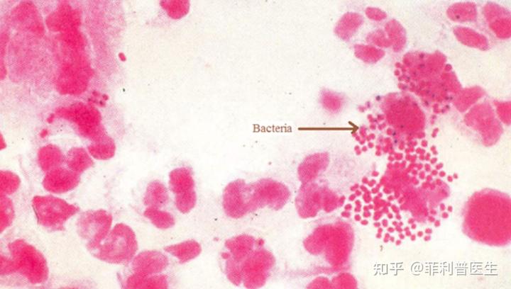 大多数人体细胞直径只有 10-30μm,细菌更是小到只有几微米甚至不 1