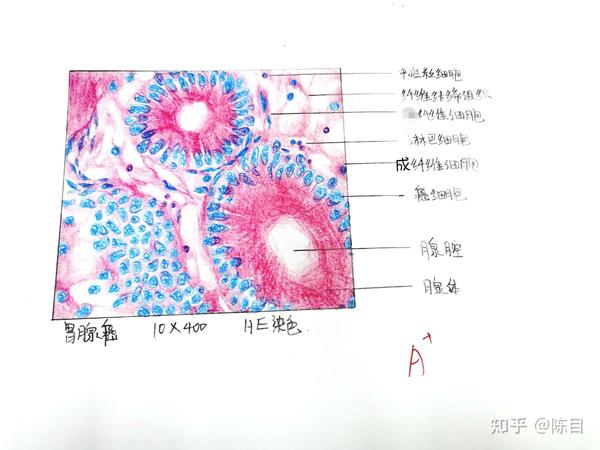 食管鳞状细胞癌 8.胃腺癌 9.脂肪肉瘤 10.动脉粥样硬化 11.