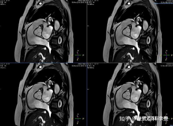 心脏磁共振技术大全三