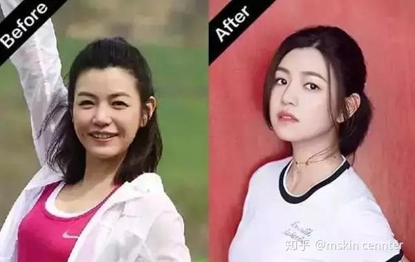 额头偏低的陈妍希在额前留几缕头发,不仅能掩盖发际线过低问题,看起来