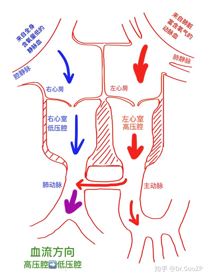 动脉导管未闭示意图(可见动脉血经动脉导管混入静脉血)动脉导管指肺