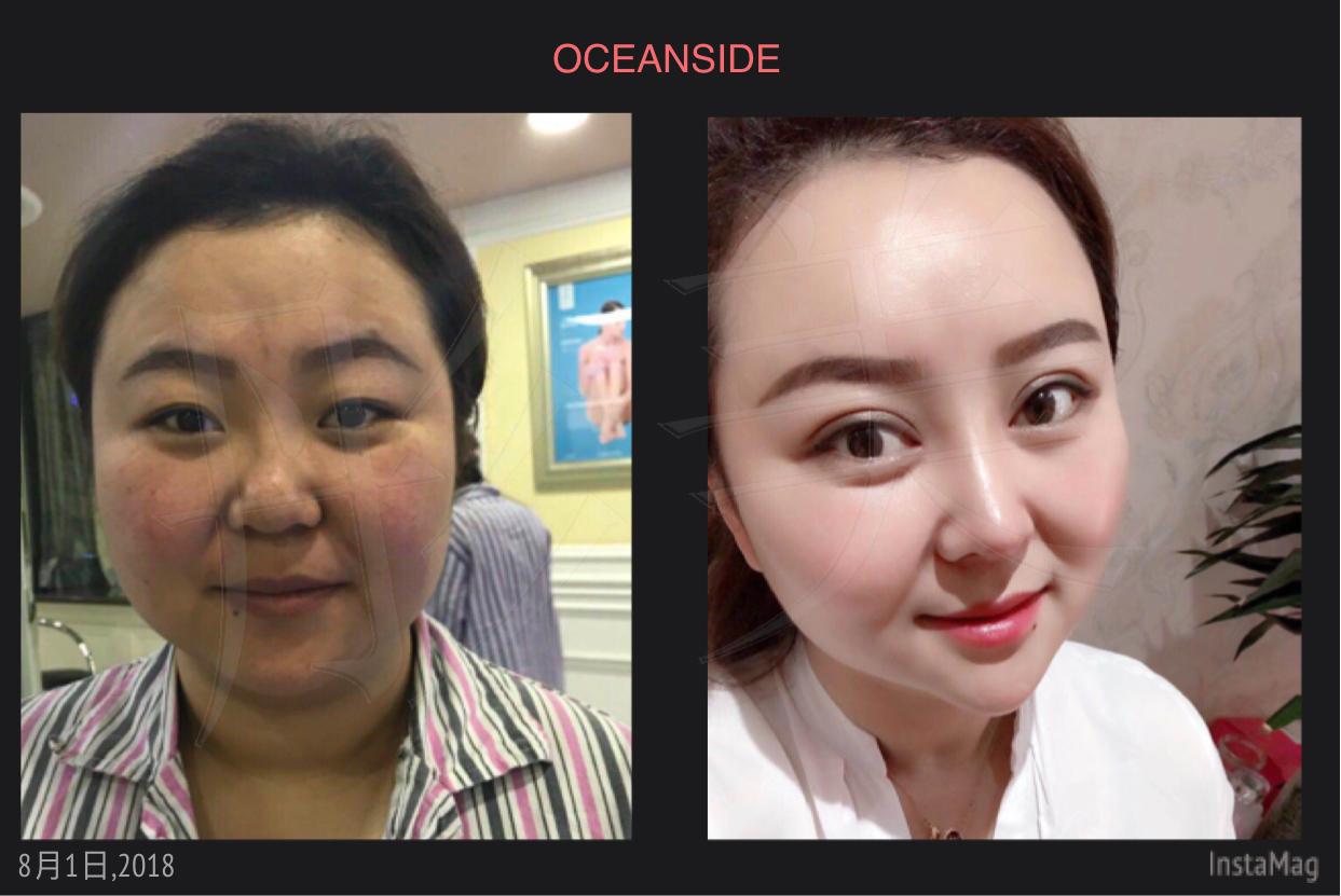 什么样的鼻子有福气?
