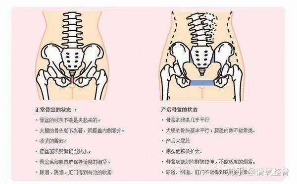 [嘿哈]治病必求于本,疾病的源头在骨盆不正