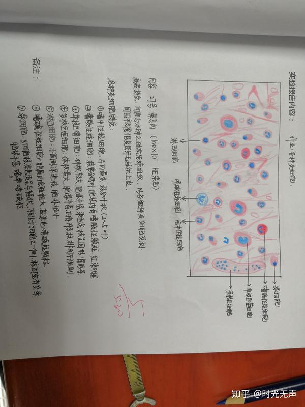 这学期病理手绘图,老师总给5-,我被宫颈原位癌难到了