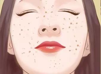 斑的种类及形成原因图片