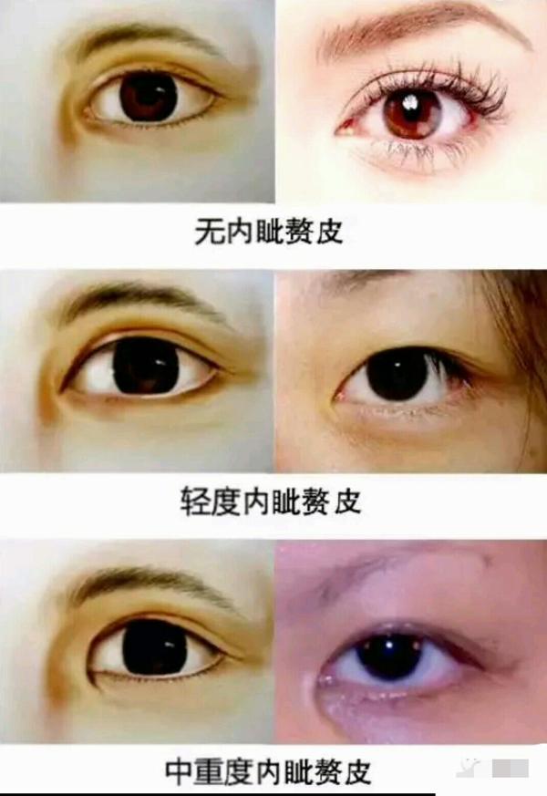 请问这是吊眼还是什么眼型?