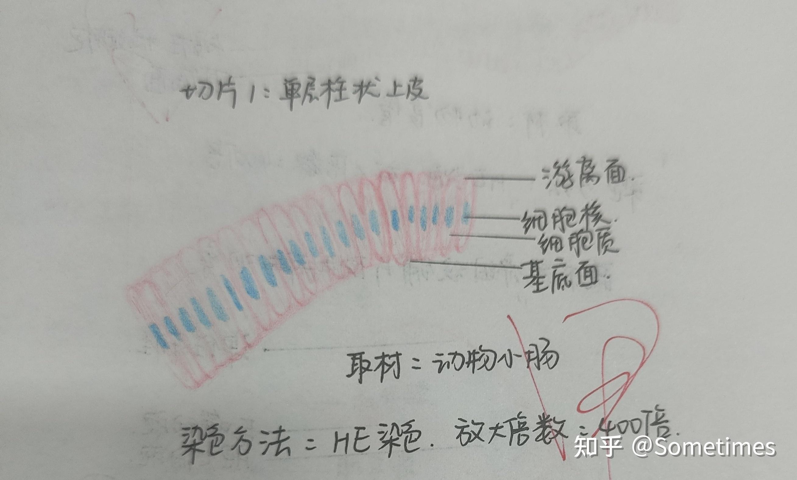 单层柱状上皮下面是我画的图,有些老师还没有批改.