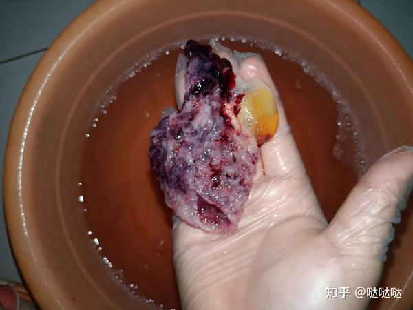 孕囊死亡如何自然流产