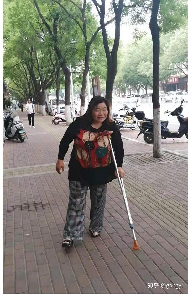 省级医院出奇迹好人治成重残疾