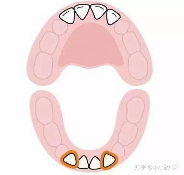 13-19个月,上齿槽长出了两颗臼齿(上颌第一乳磨牙)