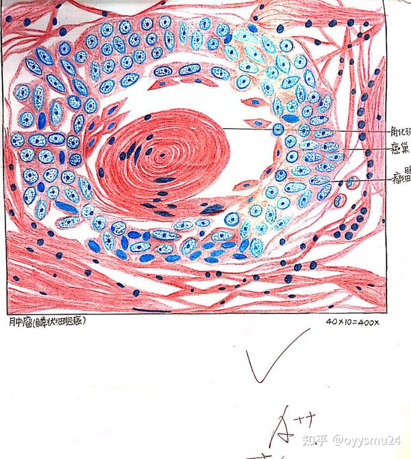 病理学红蓝铅笔画图