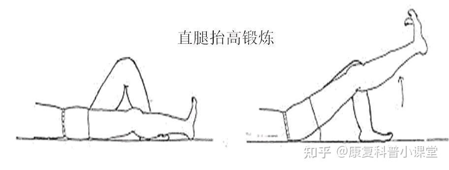前叉韧带术后一周有什么康复训练方法