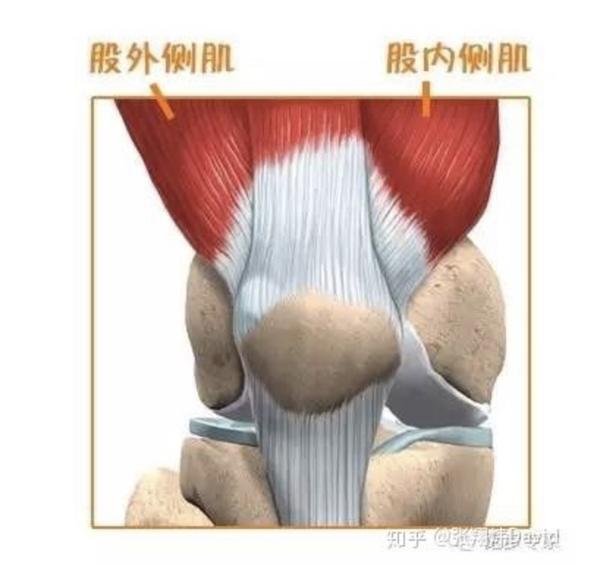 股外侧肌很强时,就会造成严重的关节失衡情况 髌骨软化或髌骨疼痛综合