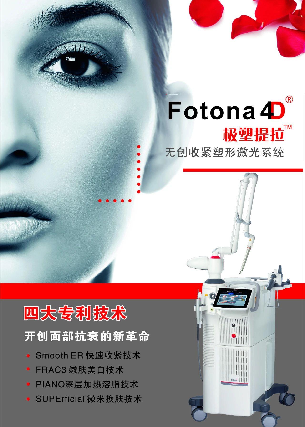 关于欧洲之星fotona4d的7个常见问答