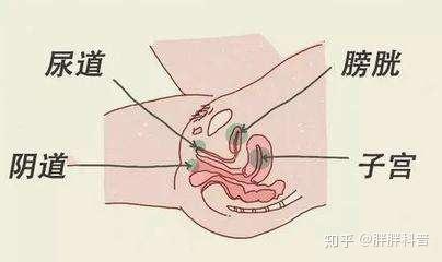 2,不洁性交,不洁性交是导致女性尿道感染的常见原因,因为在性交的