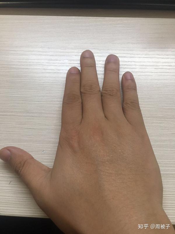 晒出你身上觉得最丑的诡异部位