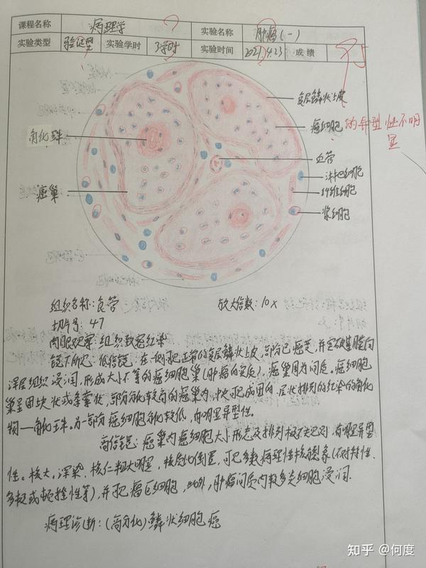 病理实验红蓝铅笔绘图