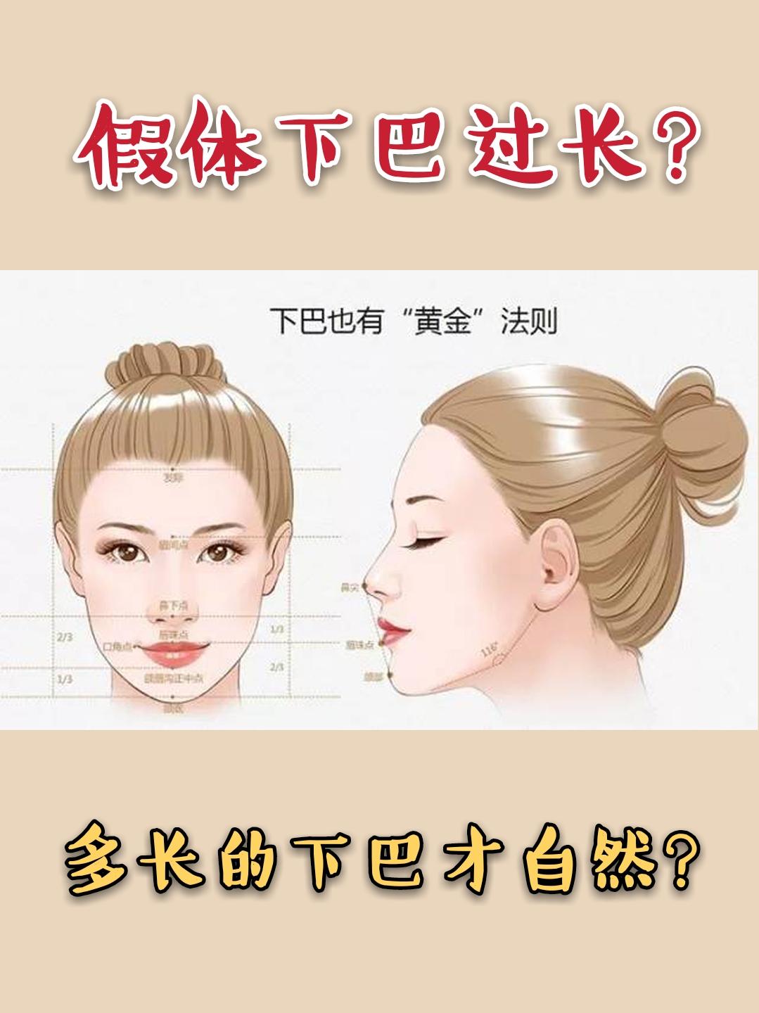 而假体下巴是否自然不仅与长度有关,还跟形状,翘度及与两侧面颊连接