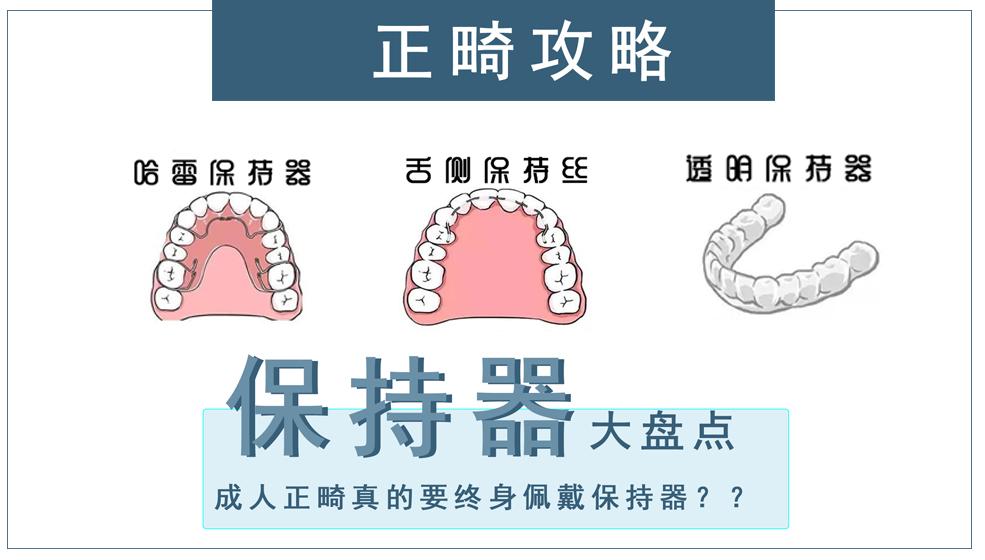 保持器大盘点成人正畸真的要终身佩戴保持器吗