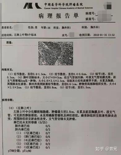 客户1左肺上叶切除术后病理报告