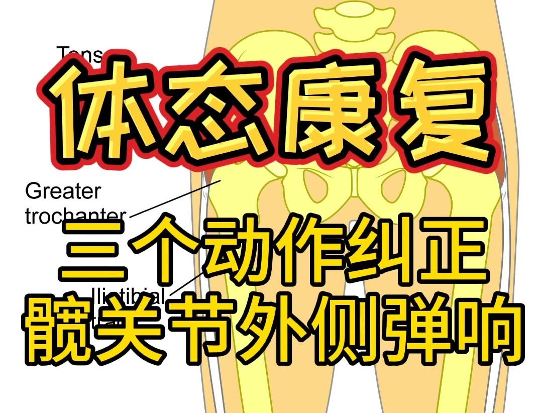 体态康复三个动作纠正髋关节外侧弹响
