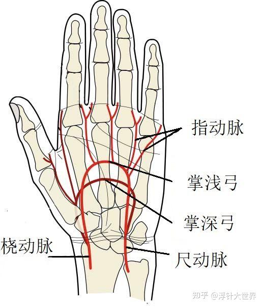 推测以尺侧腕屈肌,手指屈肌为主要患肌.