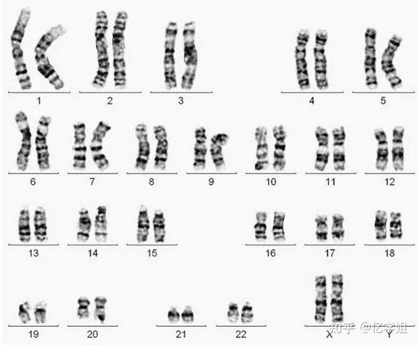 图示:人类正常染色体核型图(女性:46,xx)