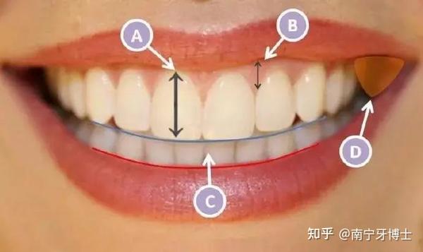 解答牙齿中线不齐脸歪能正畸改善吗