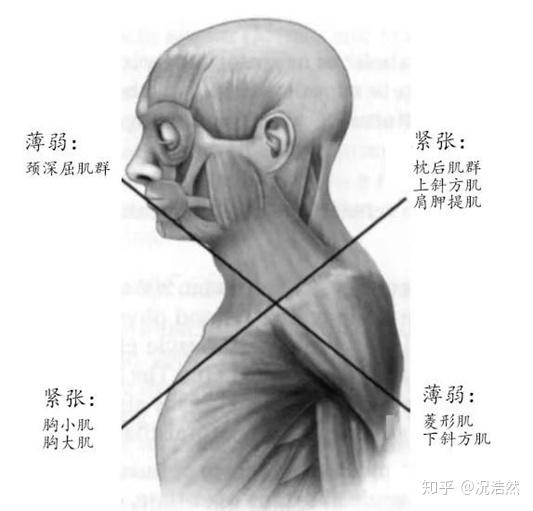 办公族体态改善——头前引