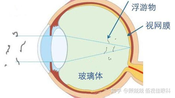 什么近视的危害有这么多