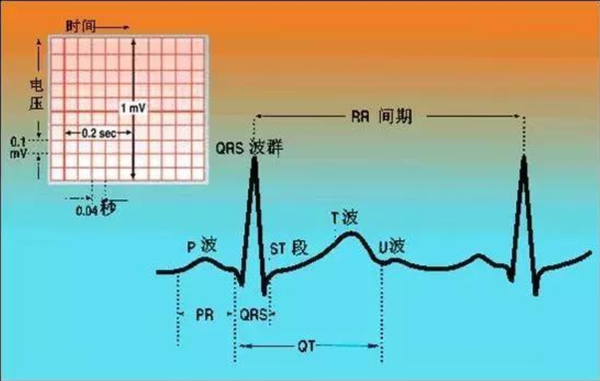 首先得知道心电图各个波群的背后含义和表现特点