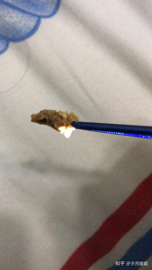 人需要掏耳朵吗?