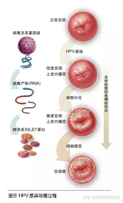 传染源 hpv的传染源是患者及病毒感染者,尤其是在患者的生殖器皮肤或