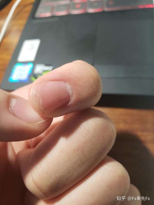 指甲中间断了怎么办