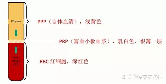 prp(platelet rich plasma),中文意思是" 高浓度血小板血浆".