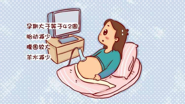 过期妊娠,千万别大意!