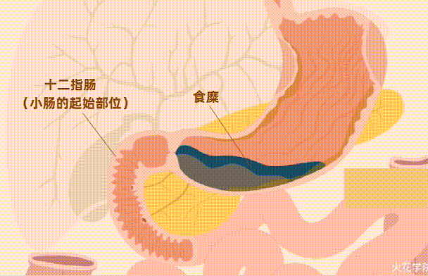一旦被吞咽,食物就会进入食道并进入 胃,暴露于强酸性胃液中, 进一步