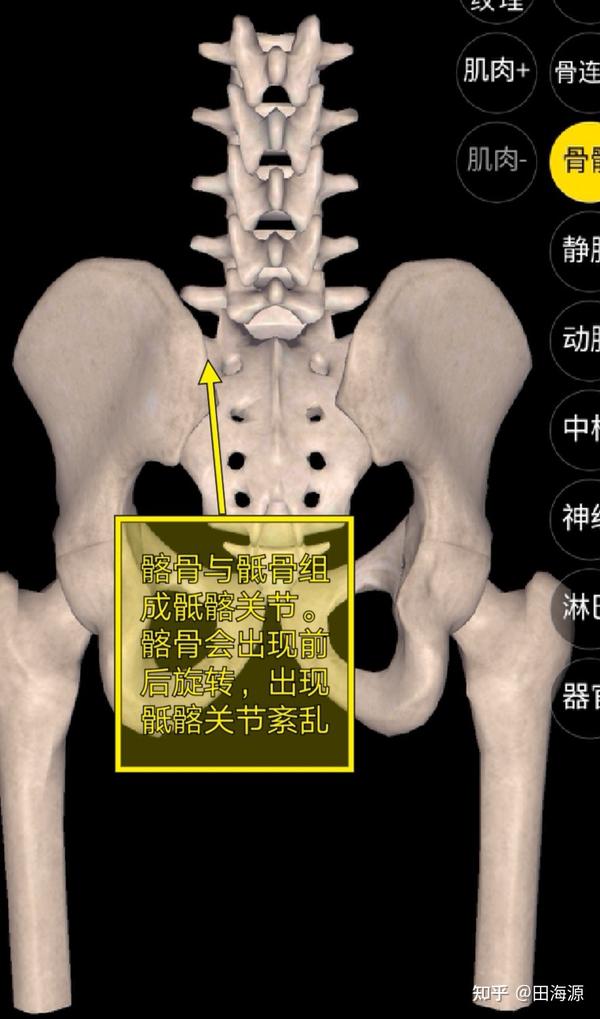 她是左侧髂骨后旋,导致左侧骶髂关节紊乱.